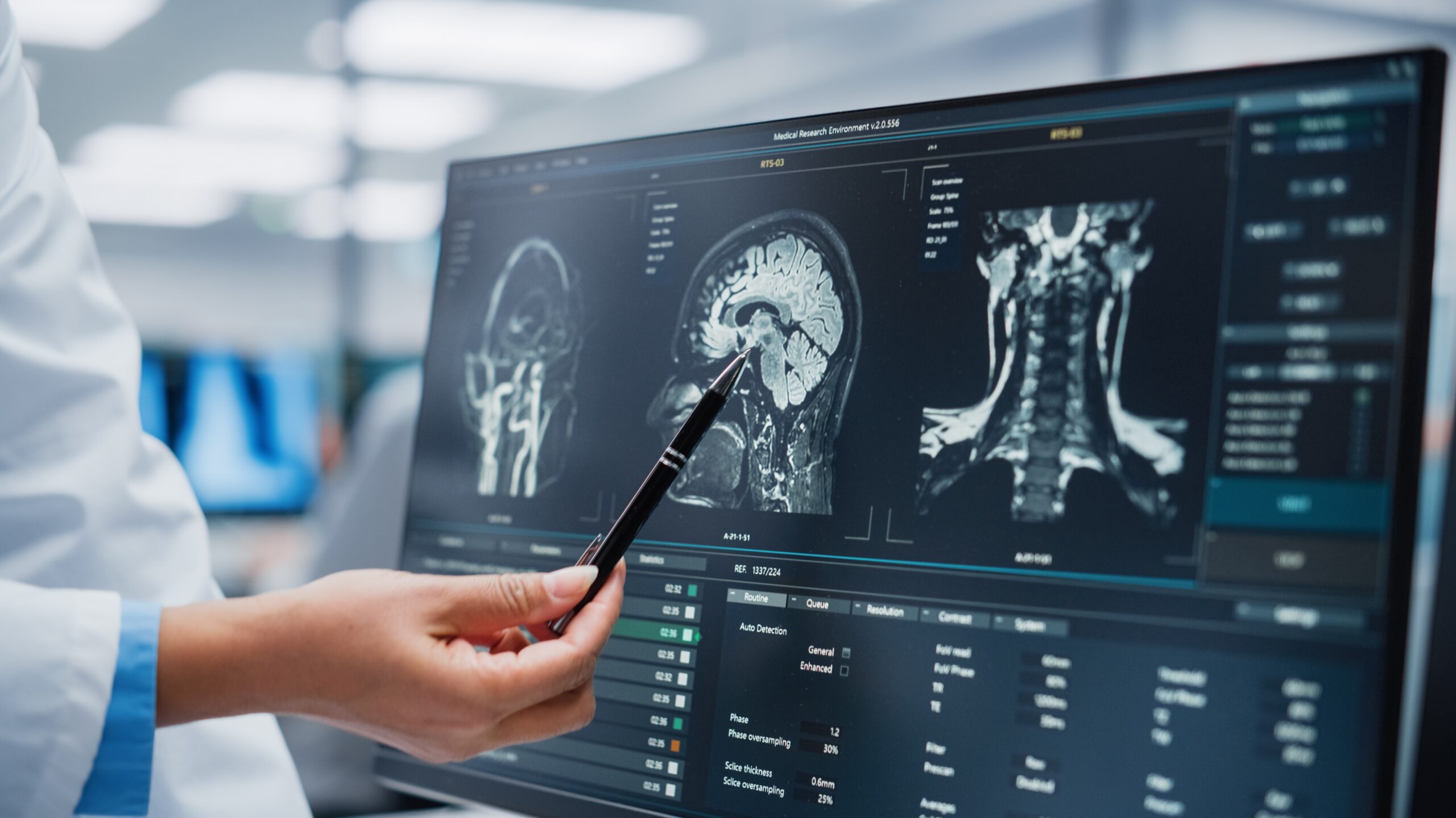 Saiba tudo sobre a Tomografia Computadorizada: entenda o preparo, o uso de contraste e as indicações. Garanta um exame seguro e um diagnóstico preciso hoje!